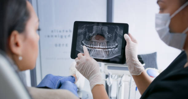 Licensed Teeth Cleaning And Checkup service in Ross, CA - Smile Center Dentistry